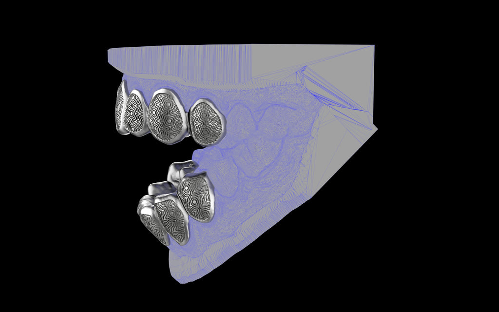 Custom Grillz / Tooth Caps - Puddled Cut
