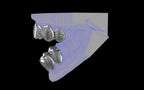 Custom Grillz / Tooth Caps - Puddled Cut