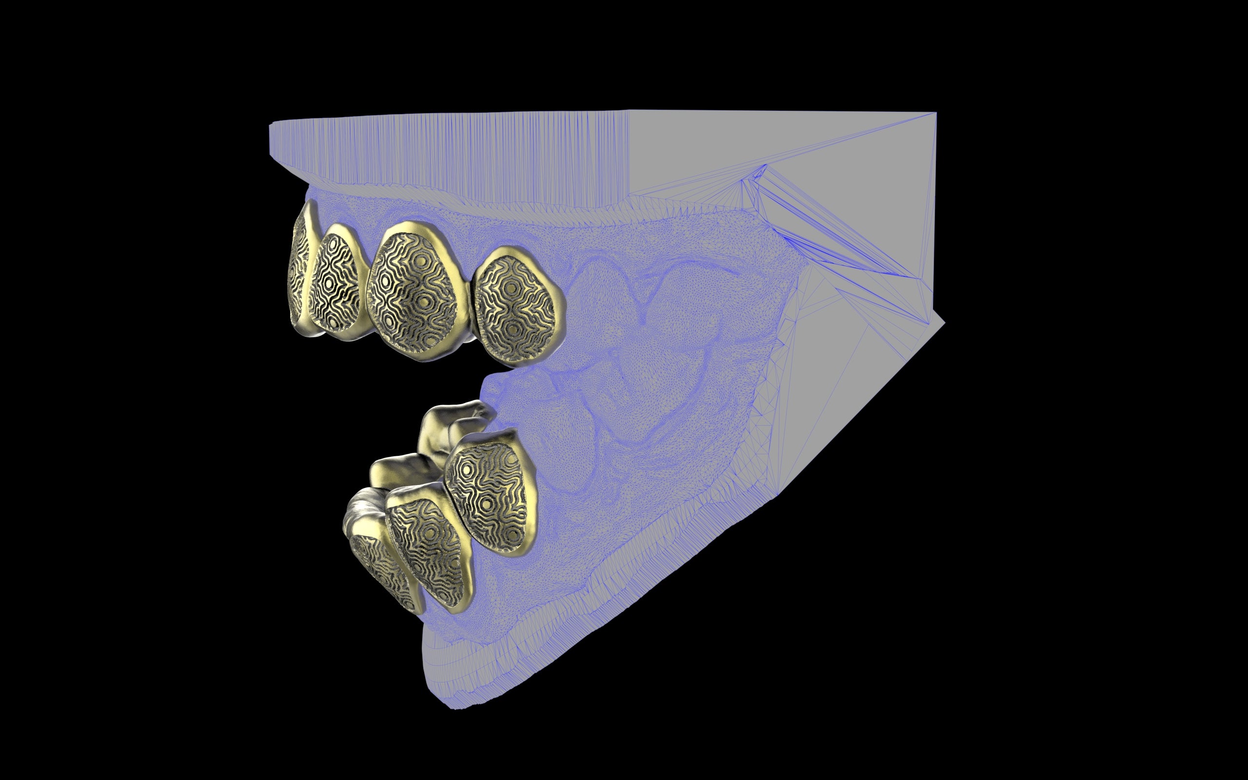 Custom Grillz / Tooth Caps - Puddled Cut