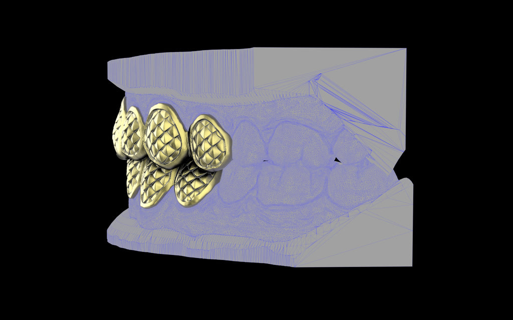 Custom Grillz / Tooth Caps - Fish Scale Cut