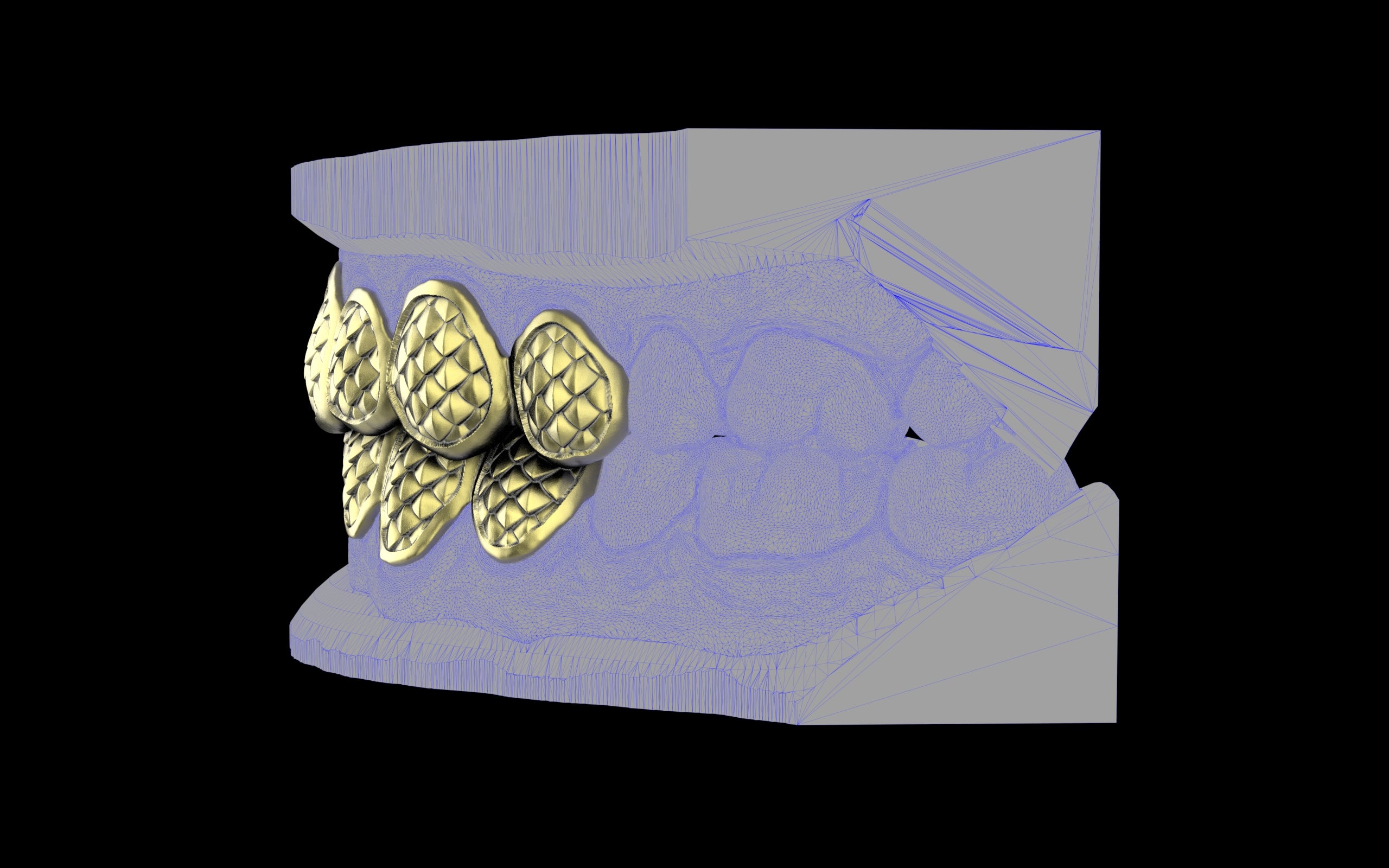 Custom Grillz / Tooth Caps - Fish Scale Cut