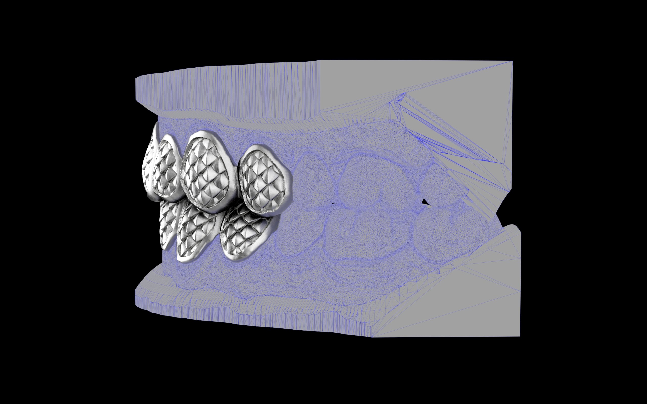Custom Grillz / Tooth Caps - Fish Scale Cut