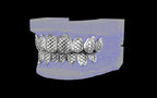 Custom Grillz / Tooth Caps - Fish Scale Cut