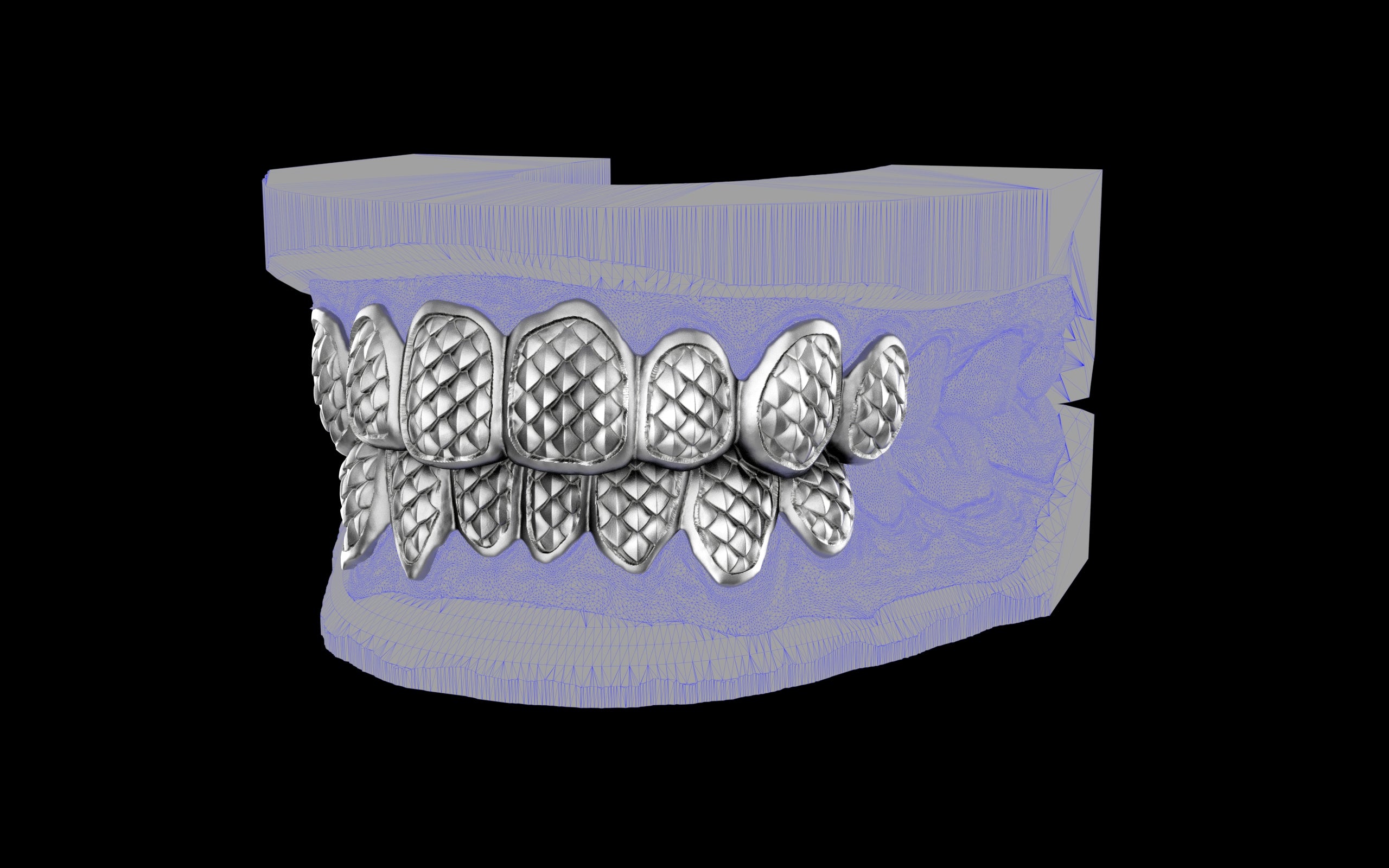 Custom Grillz / Tooth Caps - Fish Scale Cut