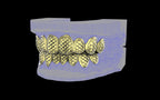 Custom Grillz / Tooth Caps - Fish Scale Cut