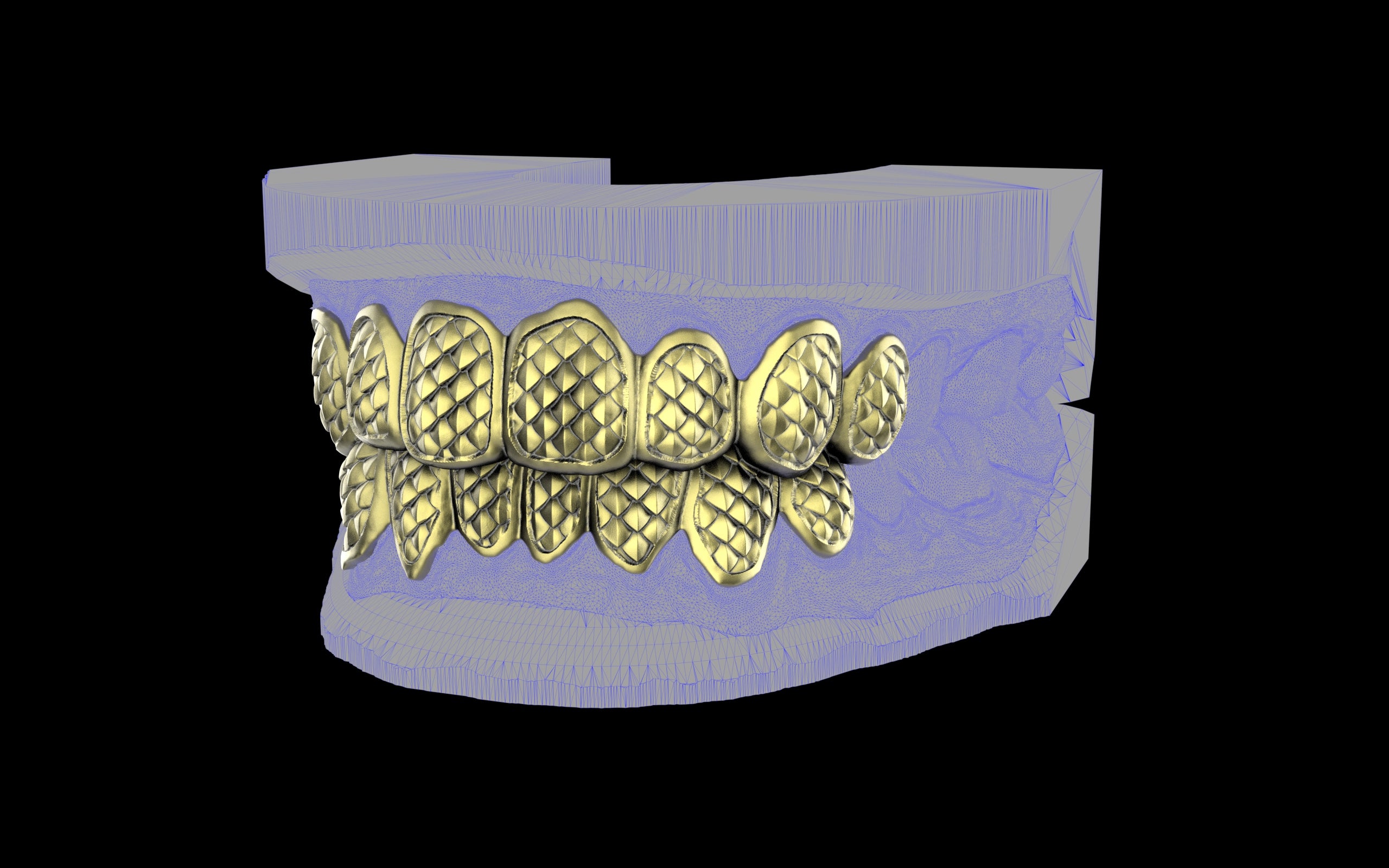 Custom Grillz / Tooth Caps - Fish Scale Cut