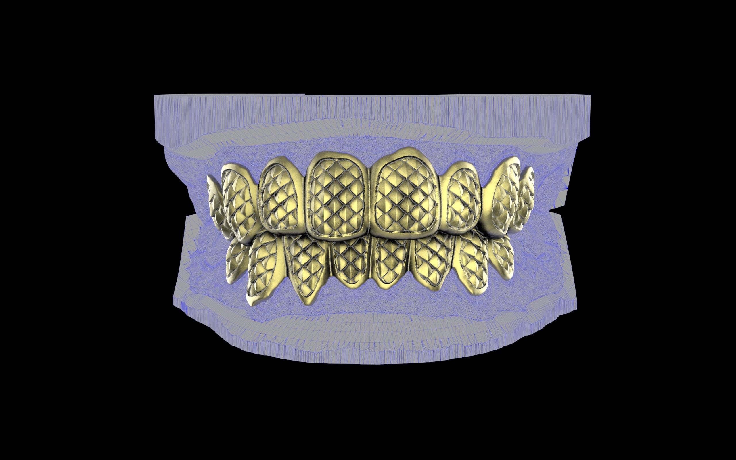 Custom Grillz / Tooth Caps - Fish Scale Cut