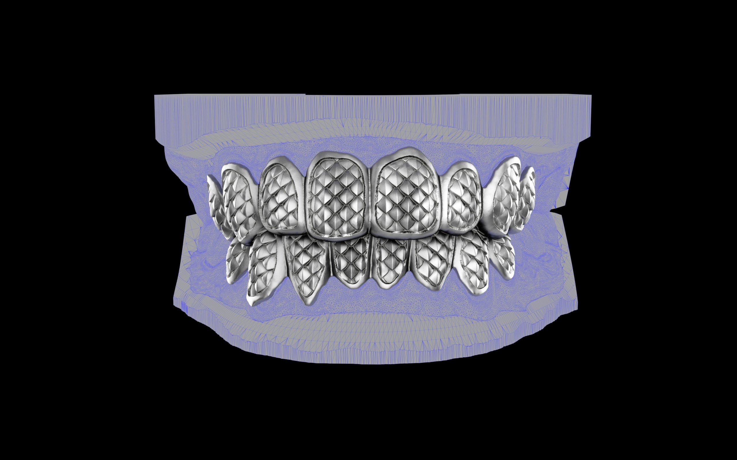 Custom Grillz / Tooth Caps - Fish Scale Cut