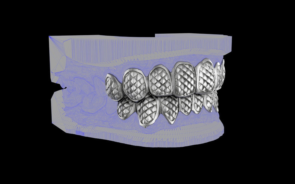 Custom Grillz / Tooth Caps - Fish Scale Cut