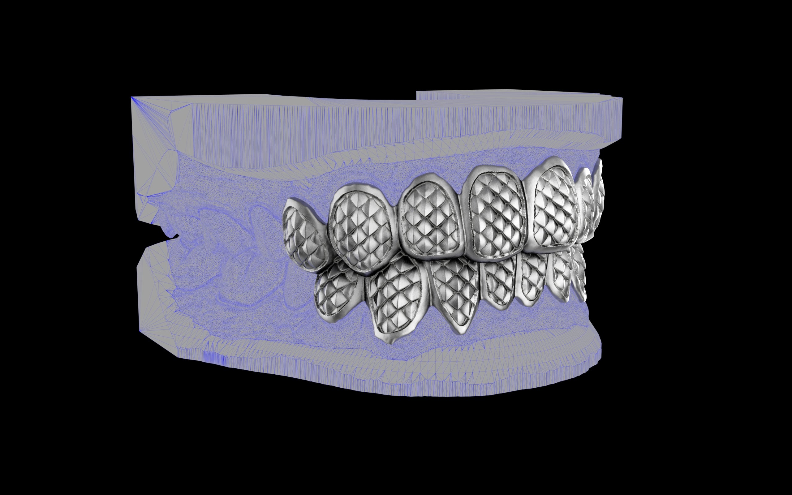 Custom Grillz / Tooth Caps - Fish Scale Cut