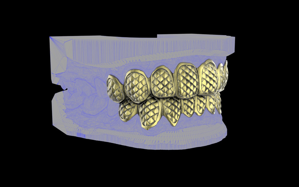 Custom Grillz / Tooth Caps - Fish Scale Cut