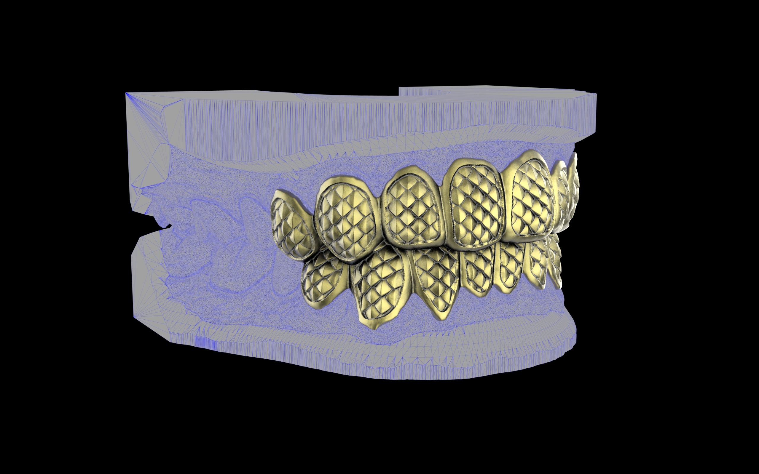Custom Grillz / Tooth Caps - Fish Scale Cut