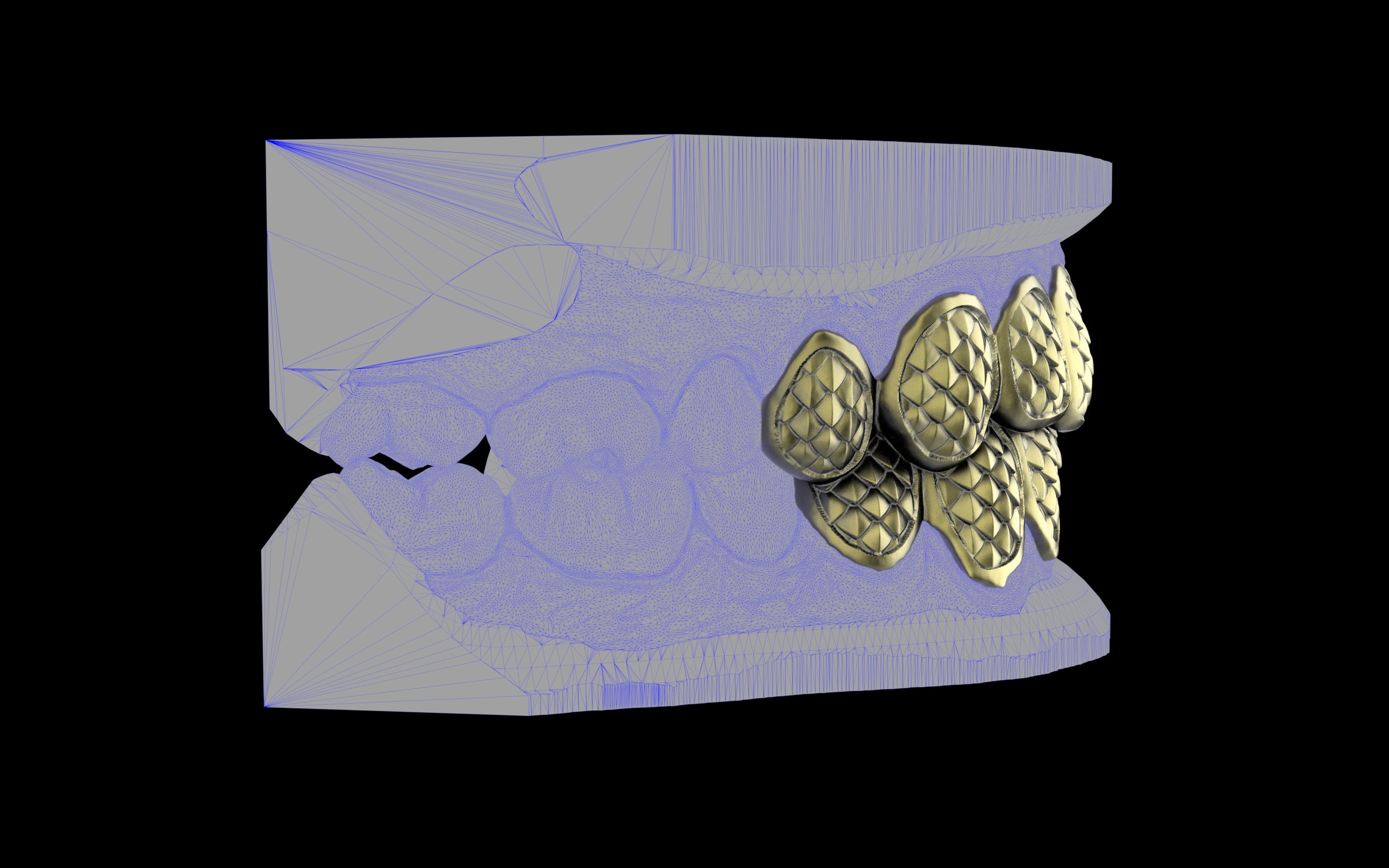 Custom Grillz / Tooth Caps - Fish Scale Cut