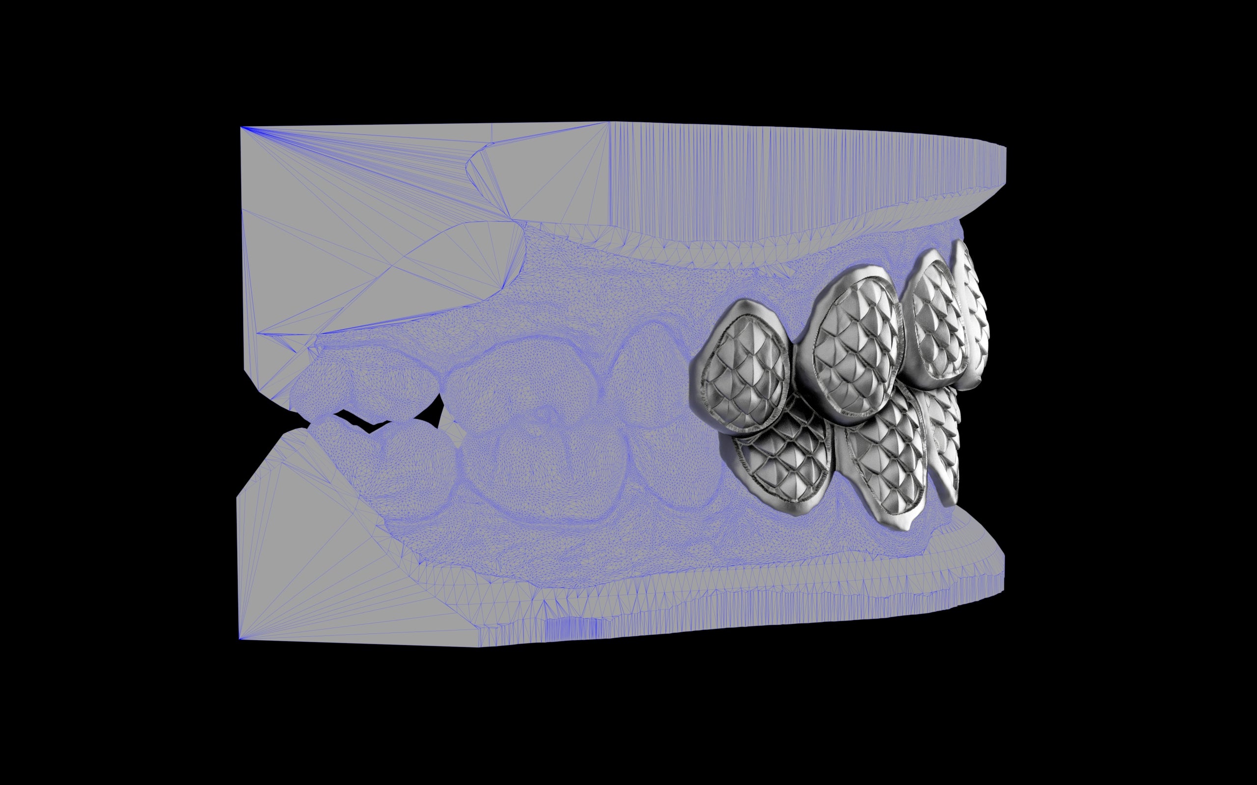 Custom Grillz / Tooth Caps - Fish Scale Cut