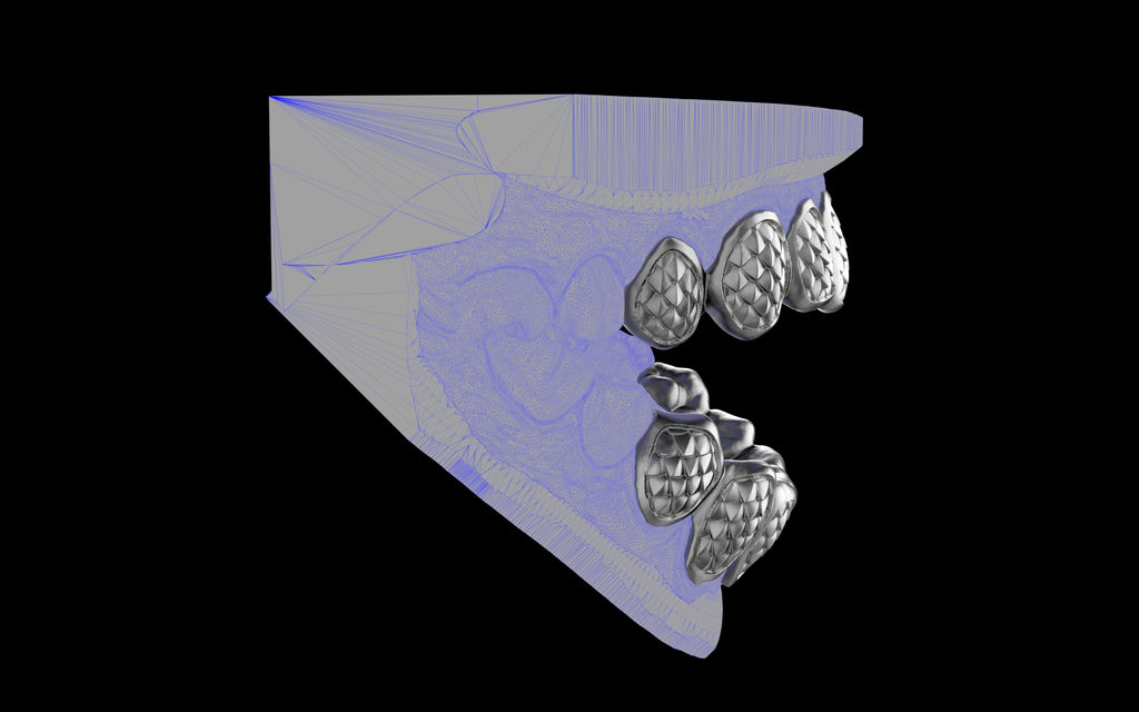 Custom Grillz / Tooth Caps - Fish Scale Cut