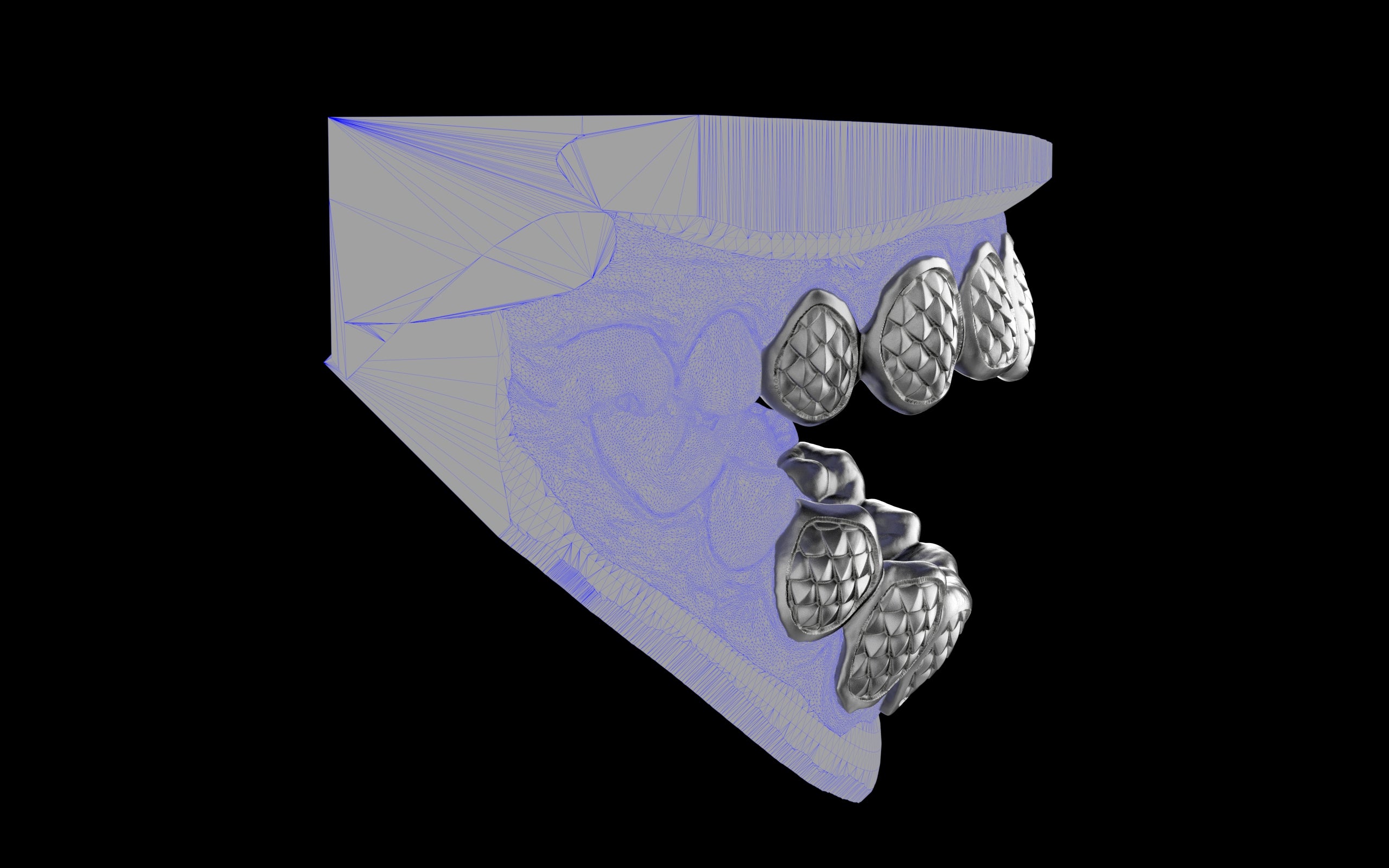 Custom Grillz / Tooth Caps - Fish Scale Cut