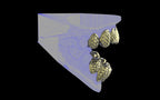 Custom Grillz / Tooth Caps - Fish Scale Cut