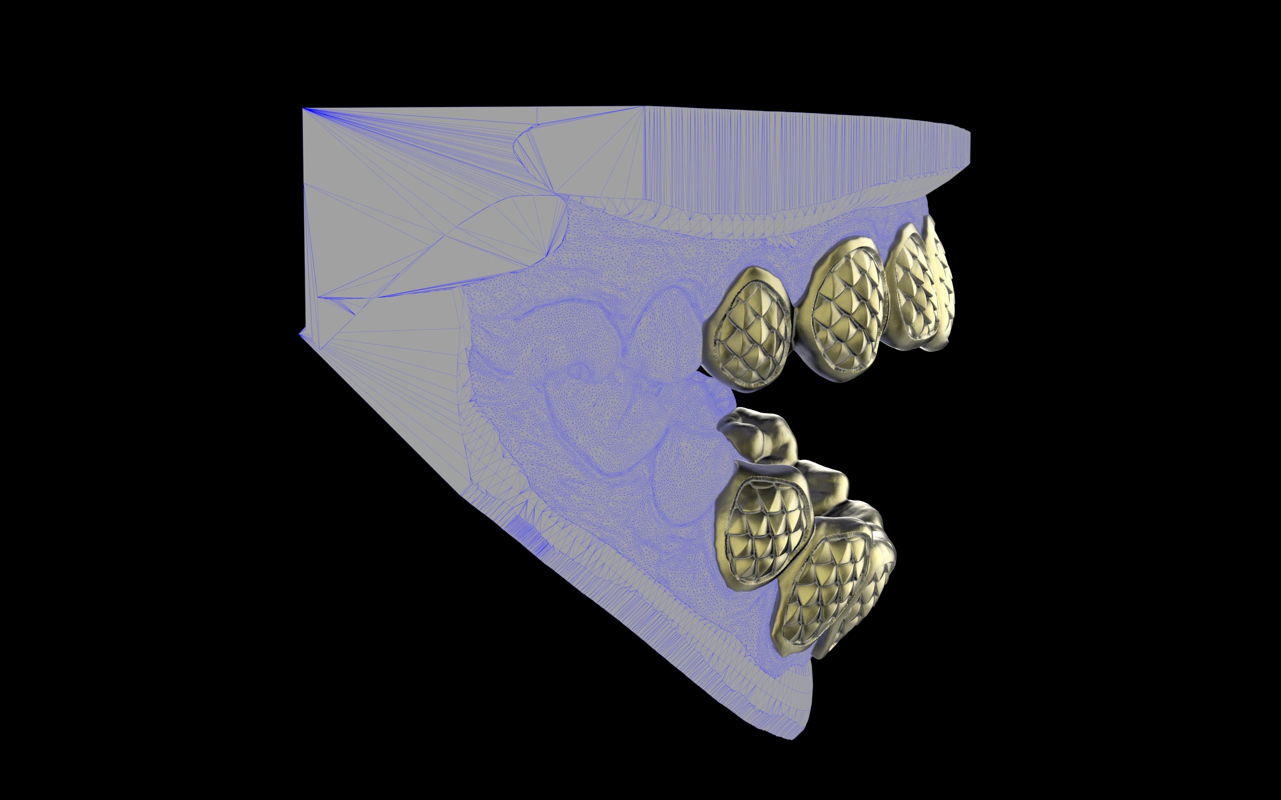 Custom Grillz / Tooth Caps - Fish Scale Cut