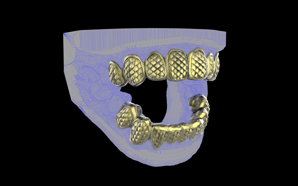 Custom Grillz / Tooth Caps - Fish Scale Cut