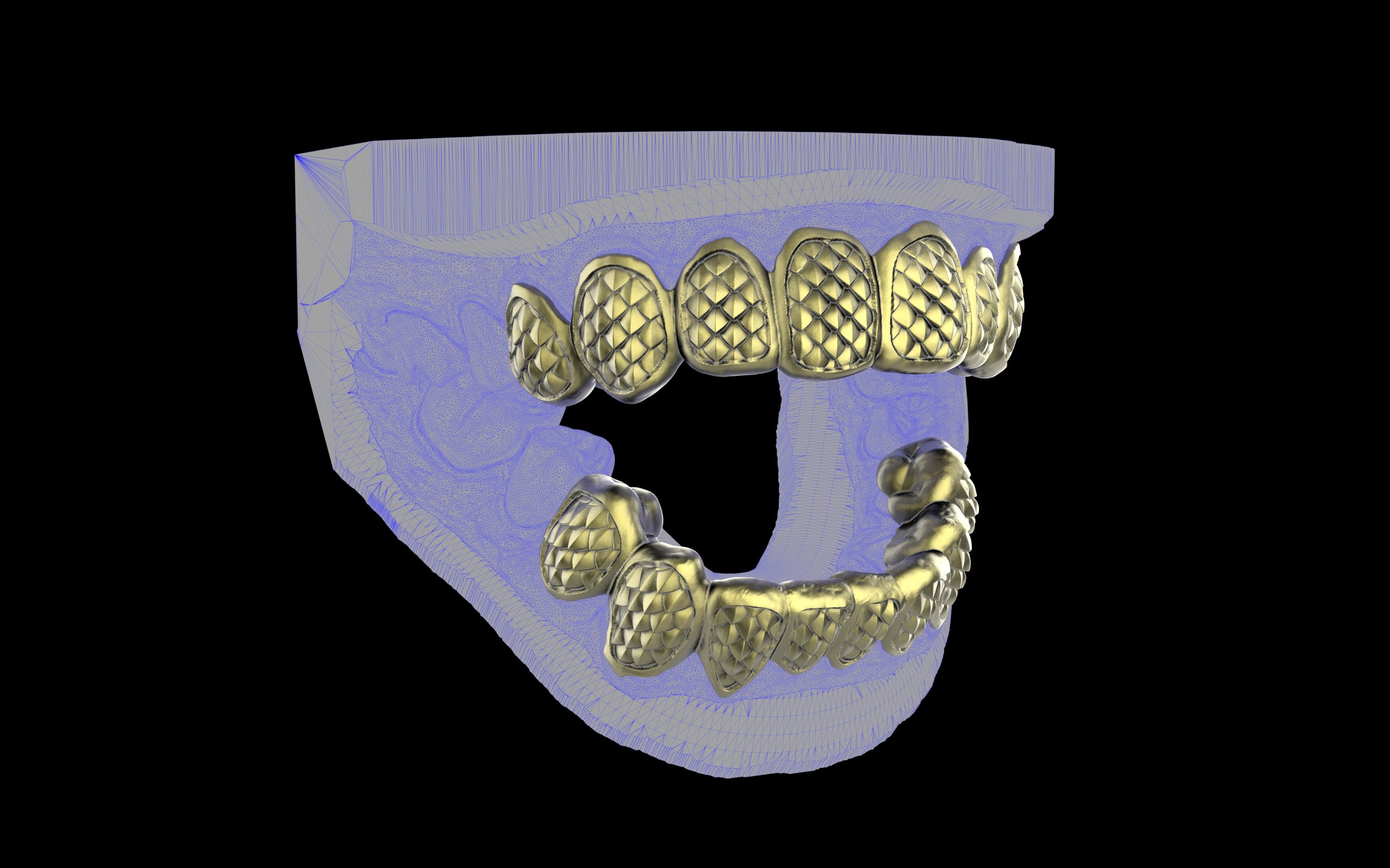Custom Grillz / Tooth Caps - Fish Scale Cut