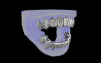 Custom Grillz / Tooth Caps - Fish Scale Cut