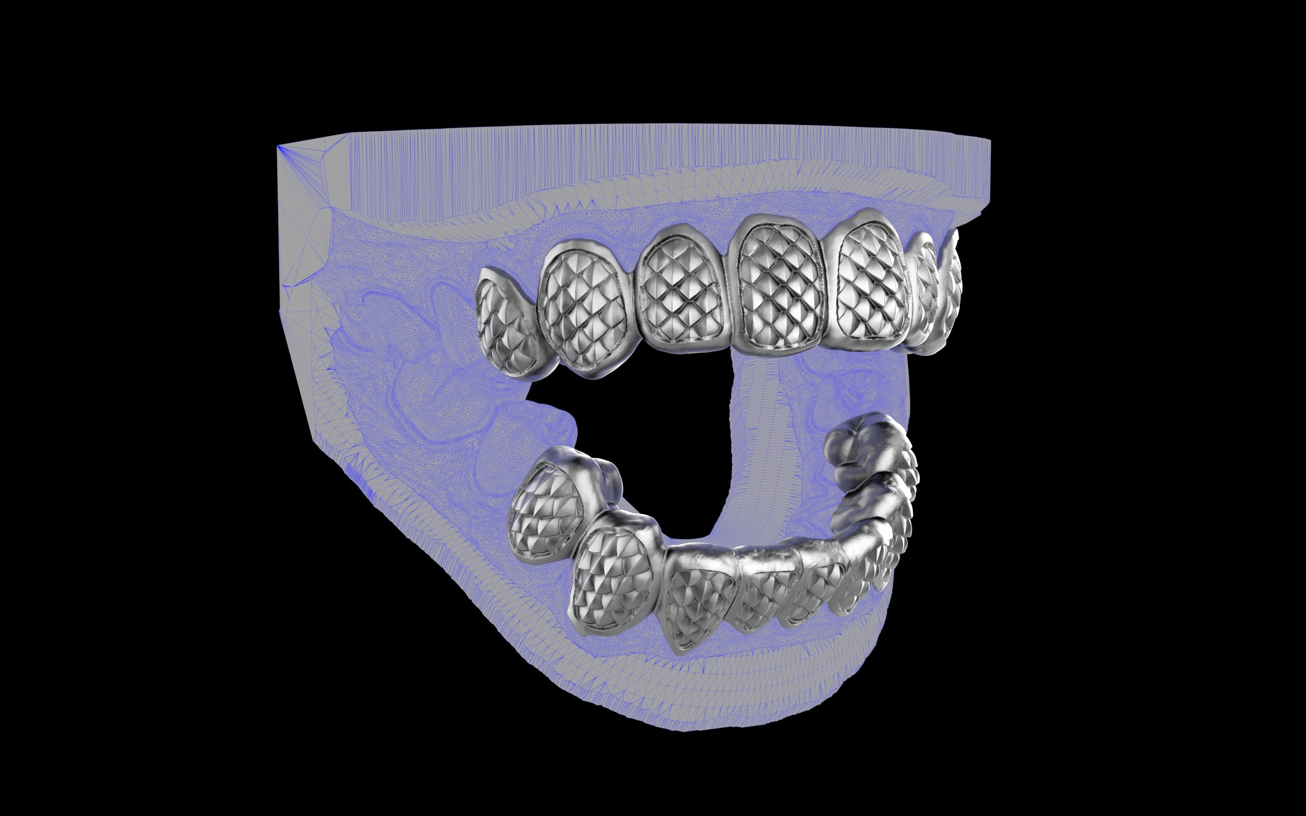 Custom Grillz / Tooth Caps - Fish Scale Cut
