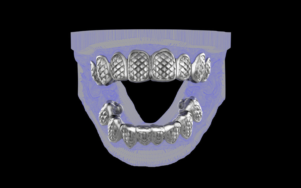 Custom Grillz / Tooth Caps - Fish Scale Cut