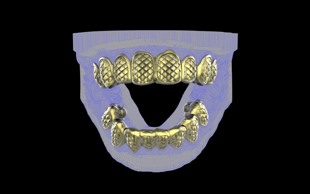 Custom Grillz / Tooth Caps - Fish Scale Cut