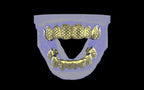 Custom Grillz / Tooth Caps - Fish Scale Cut