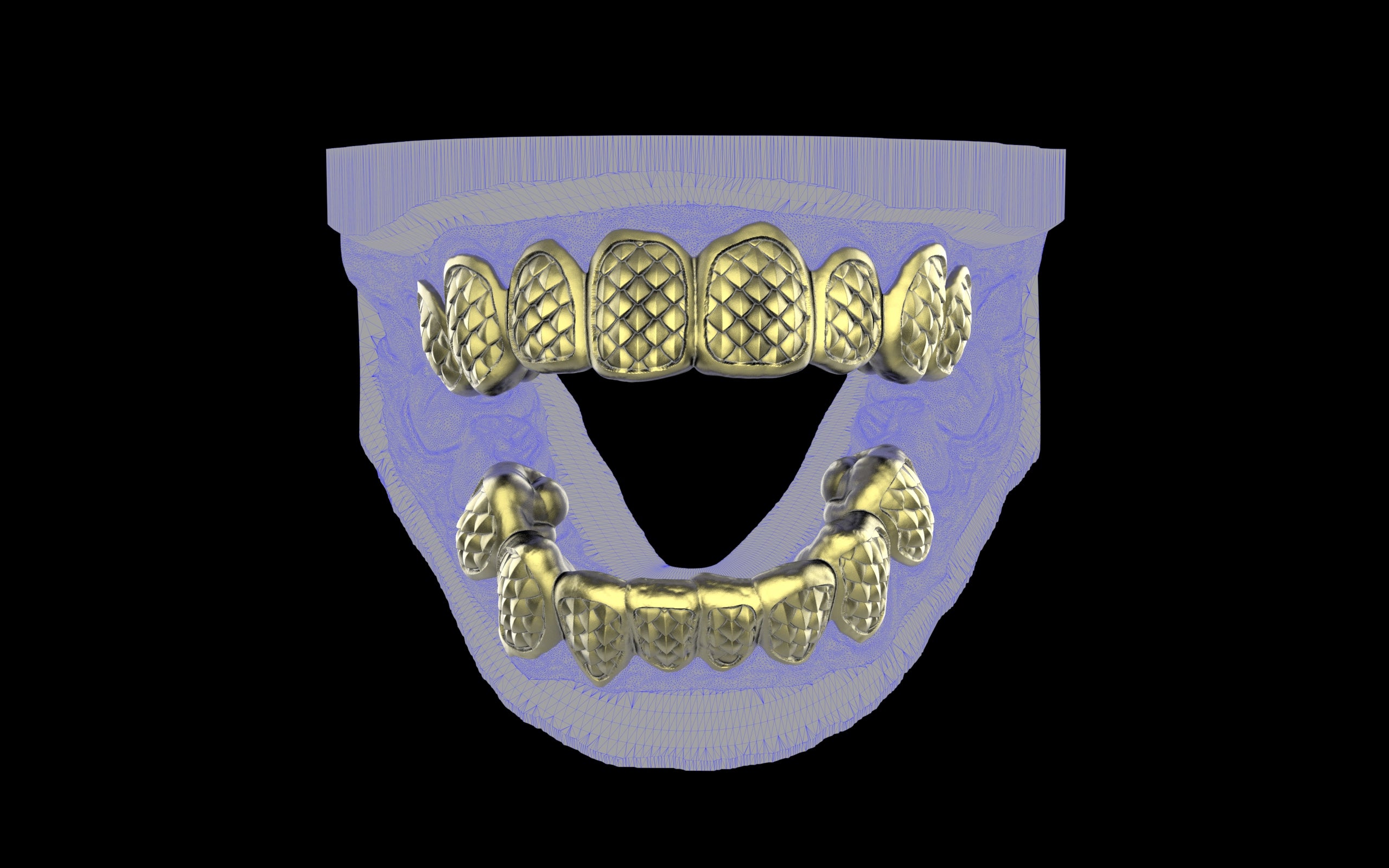 Custom Grillz / Tooth Caps - Fish Scale Cut