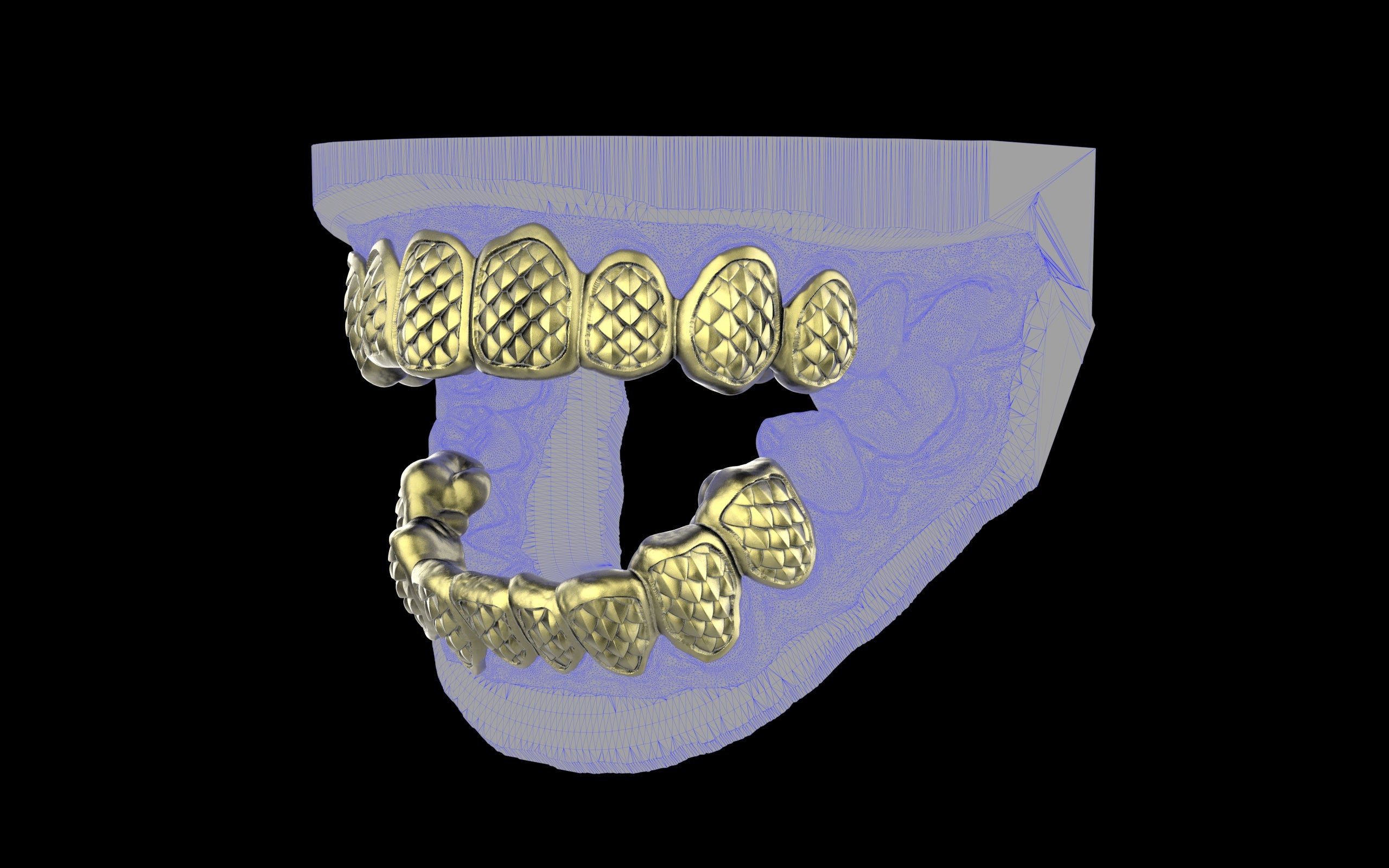 Custom Grillz / Tooth Caps - Fish Scale Cut