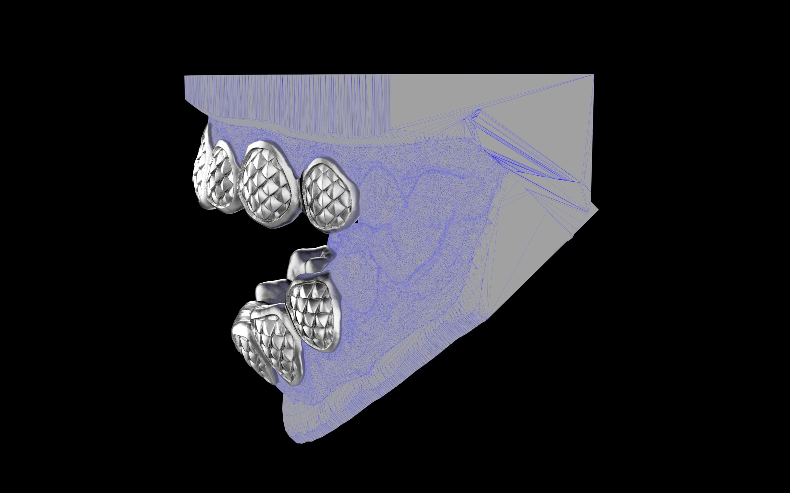 Custom Grillz / Tooth Caps - Fish Scale Cut