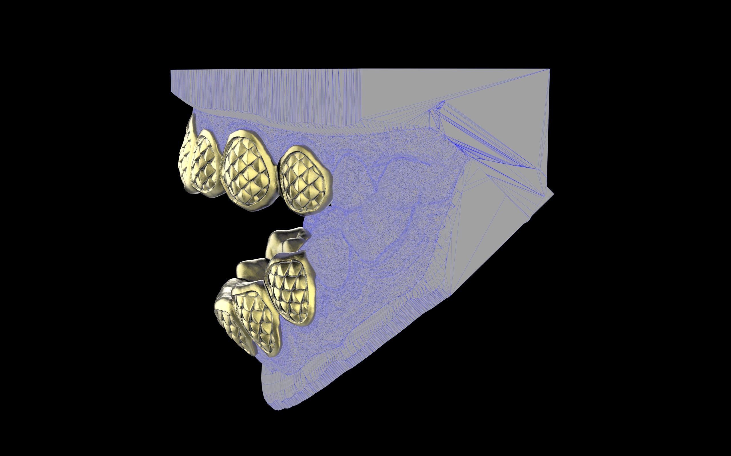 Custom Grillz / Tooth Caps - Fish Scale Cut